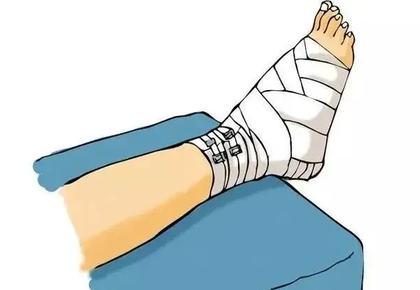 骨折了，骨頭接上就行了？